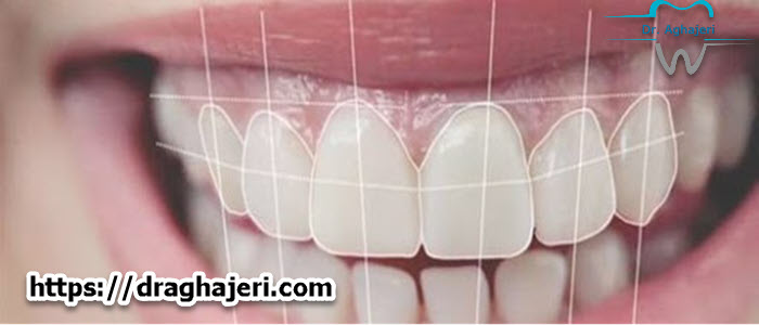 نکات مهم برای اصلاح طرح لبخند در دندانپزشکی