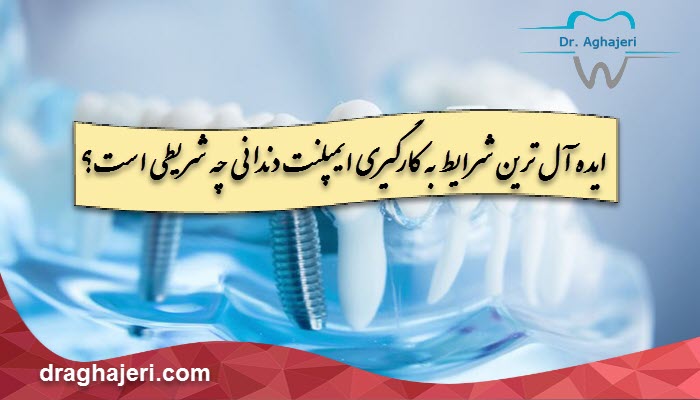 ایده آل ترین شرایط به کارگیری ایمپلنت دندانی چه شریطی است؟